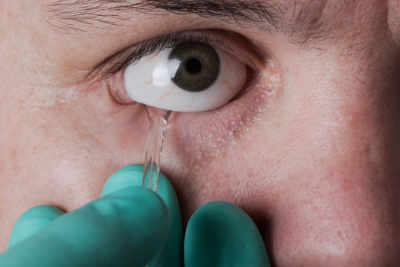 Cirugia Oculoplastica Malaga Instituto Ocular Marcos